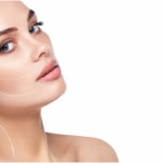 Does Endolift work well for skin tightening treatments?