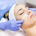 Does Glycolic Acid Peel Help Remove Dead Skin Cells?