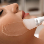 Does Glycolic Acid Peel Improve Skin Glow Naturally?