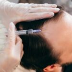 Does Hair Follicles Respond Well to GFC Therapy?