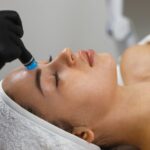 Does Hydrafacial Help With Acne Scars and Dark Spots?