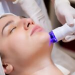 Does Pico Laser Improve Skin Elasticity Naturally?
