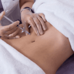 Does body filler treatment improve body proportions subtly?