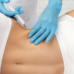 Does body filler treatment improve skin texture?