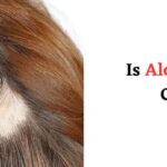 Is Alopecia Curable? Expert Guidance from the Best Hair Doctor in Kolkata – Dr. Paul’s Online