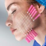 How Effective Are PDO Mono Threads for Skin Tightening Support?