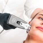 How Long Does Morpheus8 Maintain Youthful Skin Appearance?