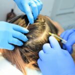 How Safe Is GFC Treatment For Hair For Sensitive Scalp Skin?