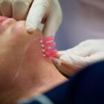How do PDO Mono Threads improve facial skin firmness?