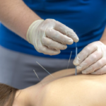 5 Ways Acupuncture Helps Balance Hormones and Boost Reproductive Health