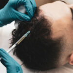 Is GFC Hair Treatment Ideal for Weak Hair Roots?