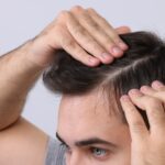Is Hair Loss Treatment Painful or Comfortable?