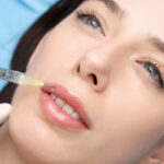 Is Lip Flip the Best Choice for a Soft Lip Lift?