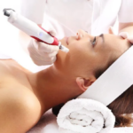 Is Microneedling Painful or Comfortable?