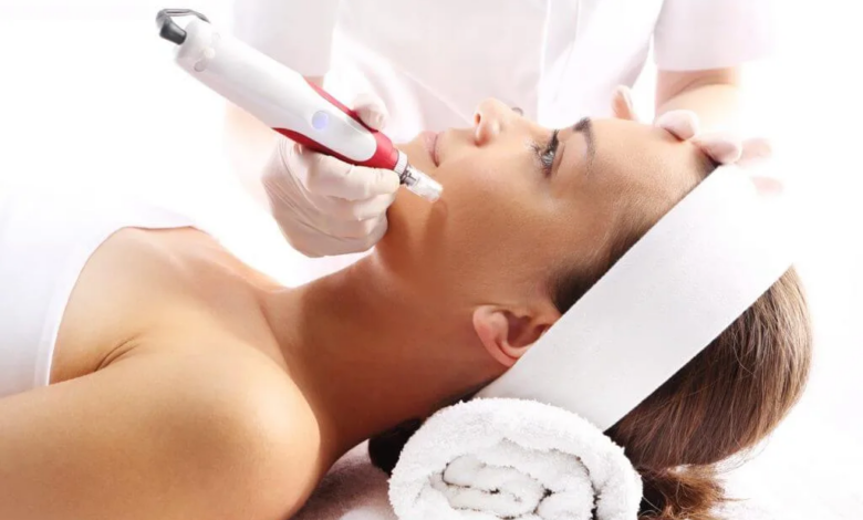 Is Microneedling Painful or Comfortable?