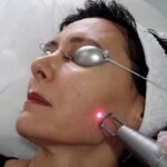 Is Pico Laser Treatment Safe for Treating Hyperpigmentation?