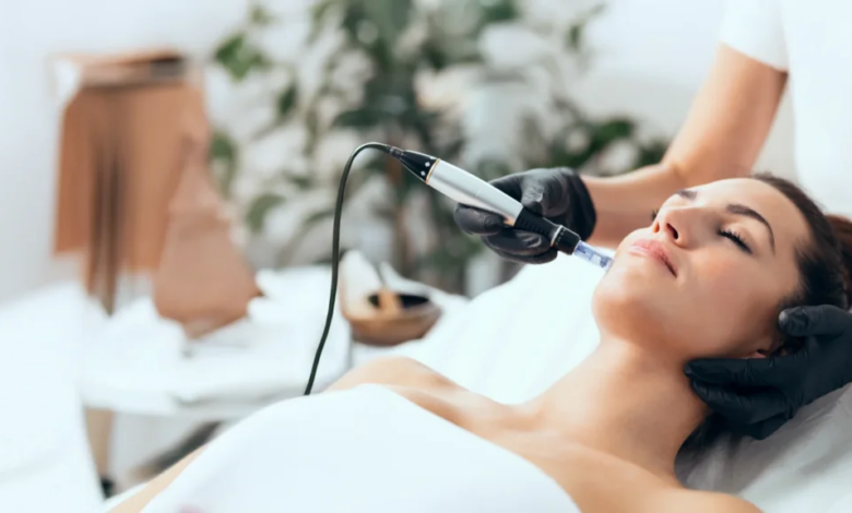 Is RF Micro Needling Painful or Comfortable?