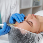 Is Sunekos Ideal for Sensitive or Thin Skin Types?