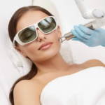 PicoSure Laser Treatment for Dull Skin: Benefits Explained