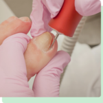 Expert Foot and Ankle Care for Ingrown Warts and Nail Conditions