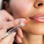 Is Russian Lip Filler best for achieving a subtle glam pout look?