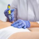 What Areas Can Be Treated with Fat Melting Injections?