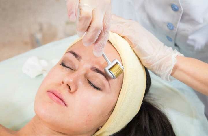 What Makes Derma Roller Treatment So Popular?