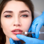 What Makes Lip Fillers a Popular Cosmetic Procedure?