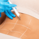 Do Weight Loss Injections boost metabolism for next level weight loss?