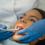 Enhance Your Smile with Composite Fillings Today a Seamless Solution for Dental Care