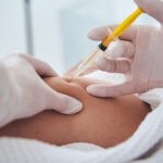Can Body Fillers Improve Body Proportions Naturally?