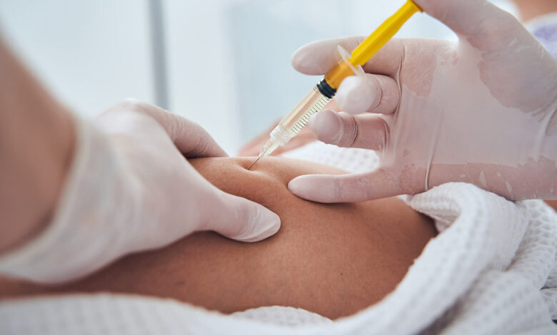Can Body Fillers Improve Body Proportions Naturally?