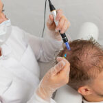 Exosome Hair Therapy in Islamabad: Modern Solution for Hair Regrowth
