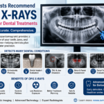 Why Dentists Recommend OPG X-Rays Before Major Dental Treatments