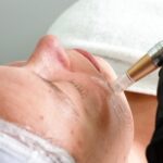Microneedling for Loose Skin: Benefits to Improve Firmness