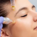PRP Treatments in Kalispell: A Natural Way to Rejuvenate Skin and Hair