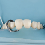 Cosmetic dentistry near me: Why proximity should be the last thing you optimize for