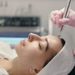 Microneedling Services in Roseville: An Effective Approach to Common Skin Concerns