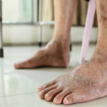 What Is Vascular Disease? Symptoms, Causes, Diagnosis, and Prevention