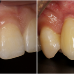 How Regular Checkups in Family Dentistry Save You Money