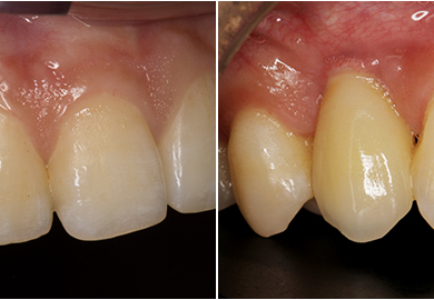 How Regular Checkups in Family Dentistry Save You Money