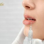 Lip Fillers Riverside for Soft Volume and a Refined Lip Shape