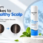 Best Shampoo for Dandruff: What Should You Buy?