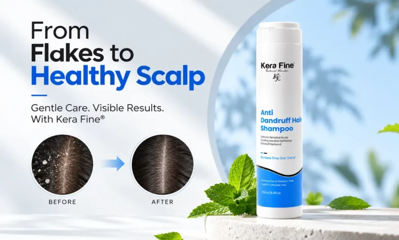 Best Shampoo for Dandruff: What Should You Buy?