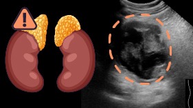 Abdomen Sonography: Pathology, Vascular Abnormalities, Trauma, and Postoperative Anatomy