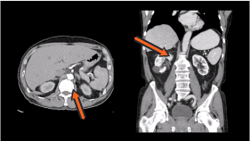 CT Anatomy and Pathology: Chest, Abdomen, Pelvis, and Extremities