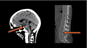 CT Procedures and Anatomy: Brain, Neck, and Spine