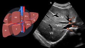 Abdomen Sonography: Anatomy, Perfusion, and Function
