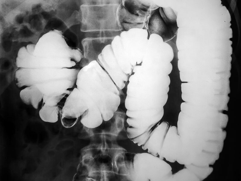 RadTechBootCamp Video Based Radiography Study ARRT Exam Prep 