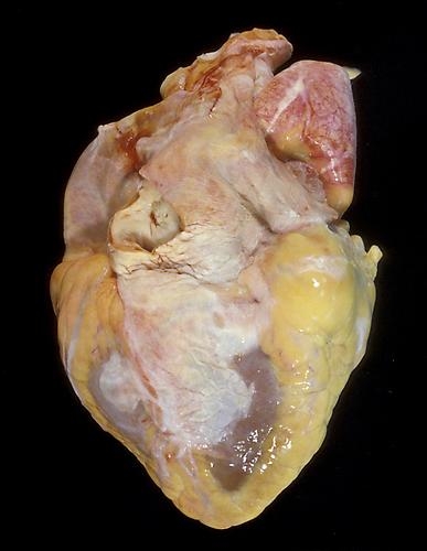 Angela Strassheim, Fatty Oversized Heart (Detail from Hearts)
